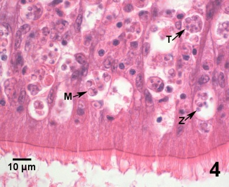 Image of Perkinsus marinus